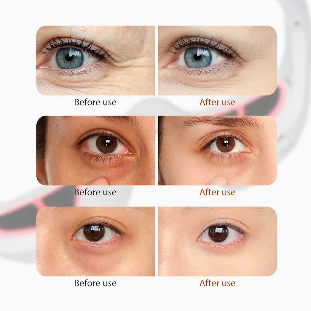 Microcurrent EMS Eye Beauty Massager with Red Light Therapy for Dark Circle Reduction