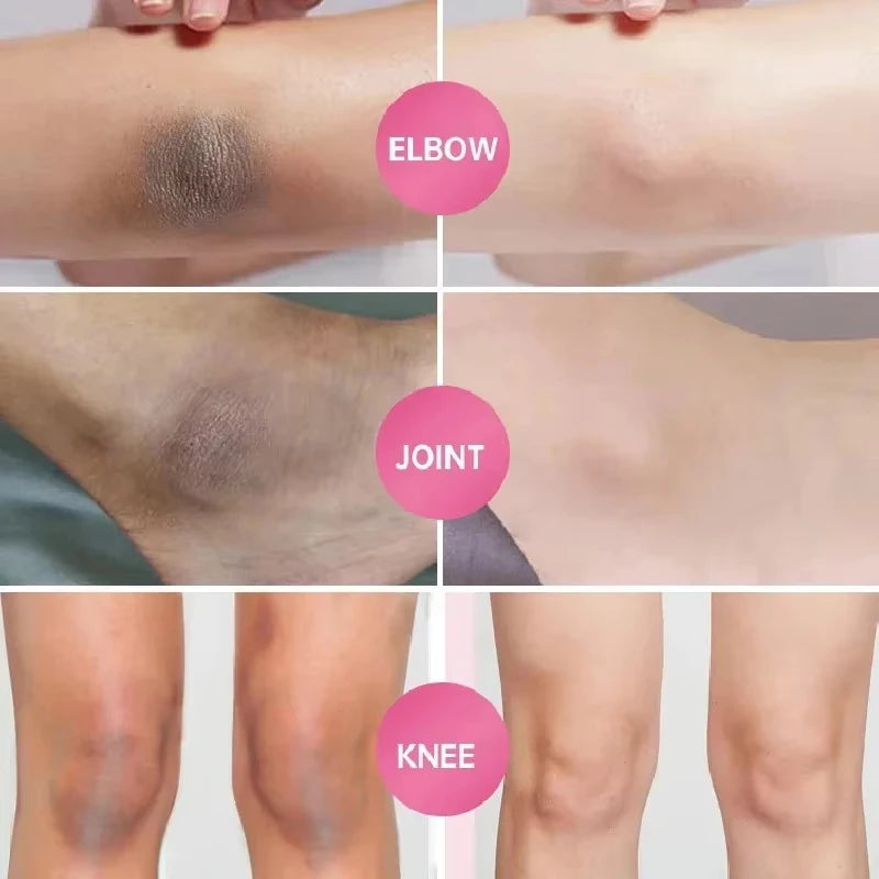 Whitening Cream For Dark Skin Armpit Thigh Inner Joint Lightening Intimate Area Underarm Body Care