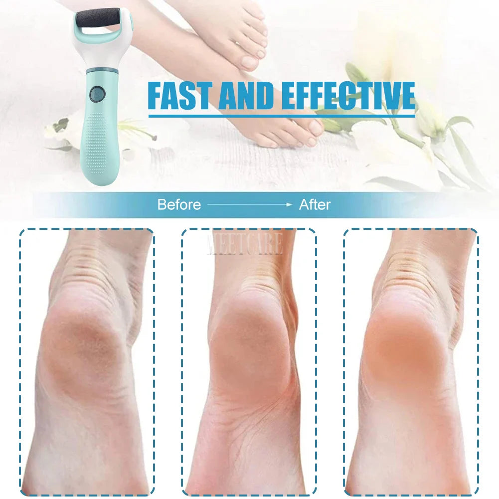 Wireless Electric Foot Grinder Smooth away calluses & cracks — fast! ? Waterproof ? Cordless &