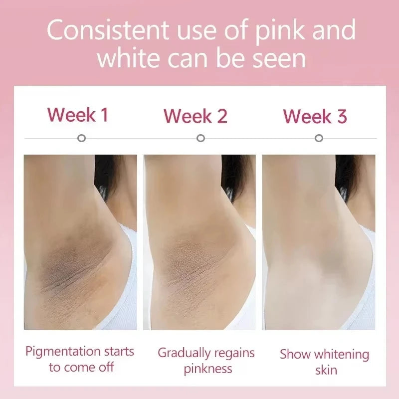 Whitening Cream For Dark Skin Armpit Thigh Inner Joint Lightening Intimate Area Underarm Body Care