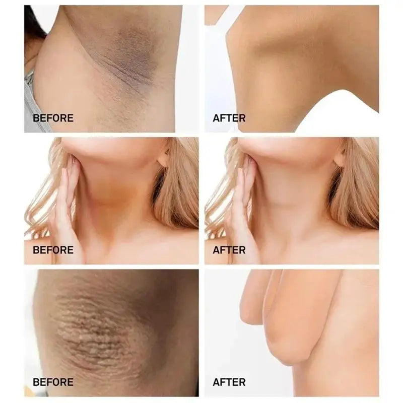 Whitening Cream For Dark Skin Armpit Thigh Inner Joint Lightening Intimate Area Underarm Body Care