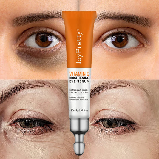 JoyPretty Anti Dark Circle Eye Cream